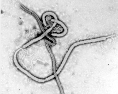 Ebola en RDC