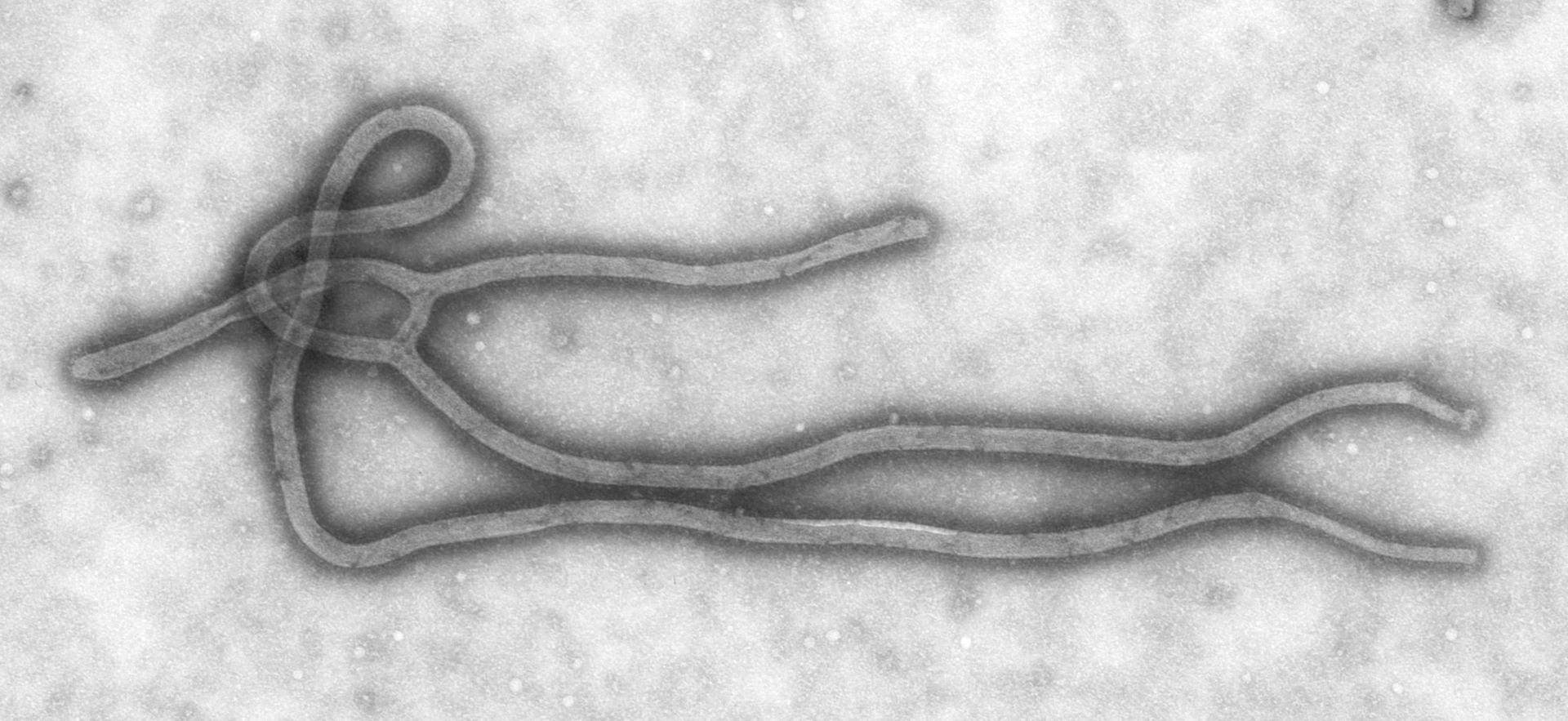Nigeria : état d'alerte après un premier cas mortel d'Ebola